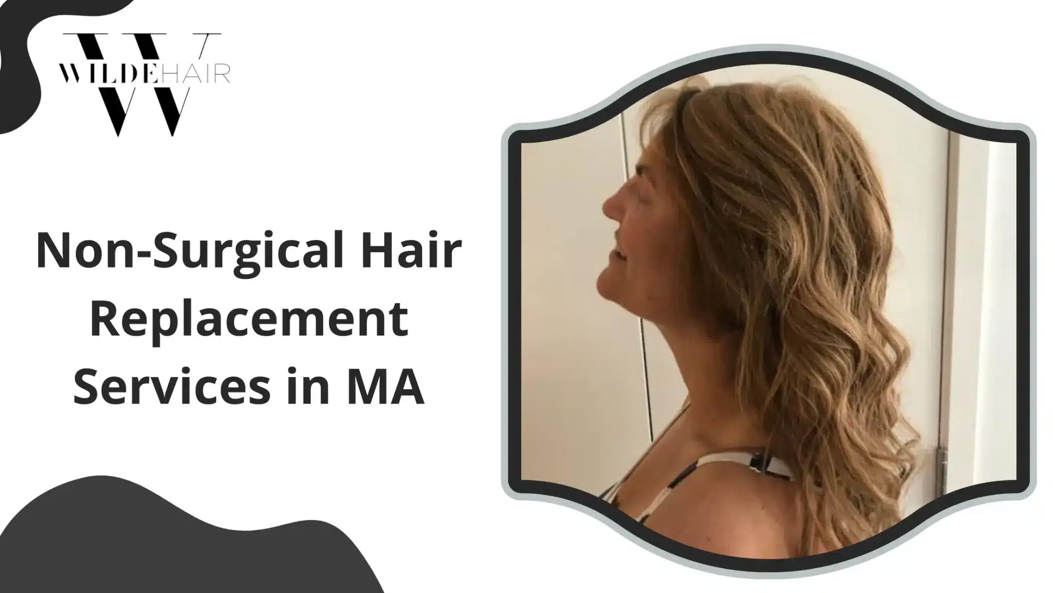 Hair Replacement near me
